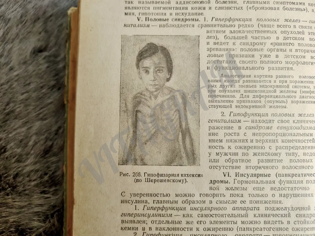 Диагностика внутренних болезней, Черноруцкий